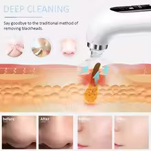 Aspirateur électrique pour pores, dissolvant de points noirs, Micro petites bulles, Machine de nettoyage du visage, dispositif de beauté Rechargeable par USB, 2025