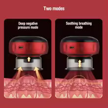 Appareil de massage électrique Chi ping, aspiration sous vide, standardisation EMS, thérapie magnétique anti-cellulite, grattage Guasha, Eva de graisse, amincissant